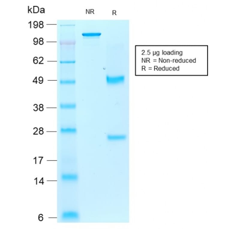 SDS-PAGE - Anti-Iba1 Antibody [rAIF1/1909] (A248418) - Antibodies.com