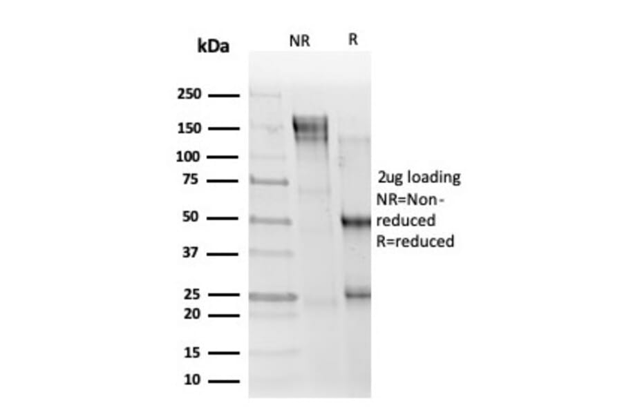 SDS-PAGE - Anti-ELK1 Antibody [PCRP-ELK1-1B9] (A248420) - Antibodies.com