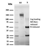 SDS-PAGE - Anti-ELK1 Antibody [PCRP-ELK1-1D9] (A248421) - Antibodies.com