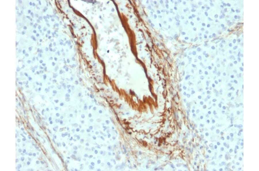 Immunohistochemistry - Anti-Elastin Antibody [ELN/2069] (A248423) - Antibodies.com