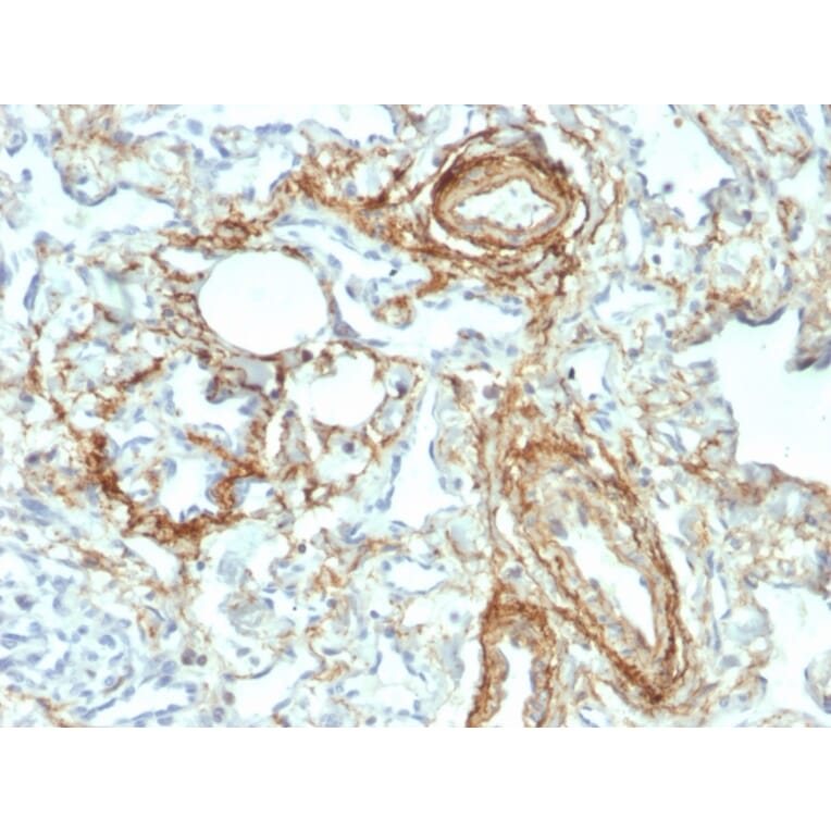 Immunohistochemistry - Anti-Elastin Antibody [ELN/2069] (A248422) - Antibodies.com