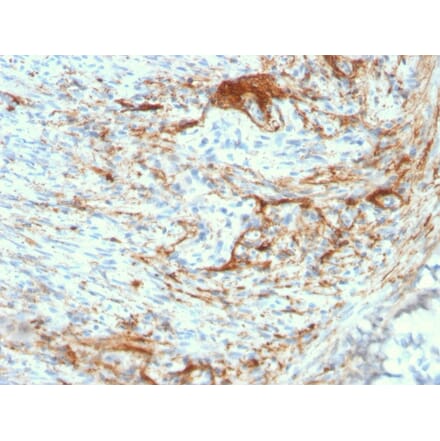 Immunohistochemistry - Anti-Elastin Antibody [ELN/3131R] (A248424) - Antibodies.com