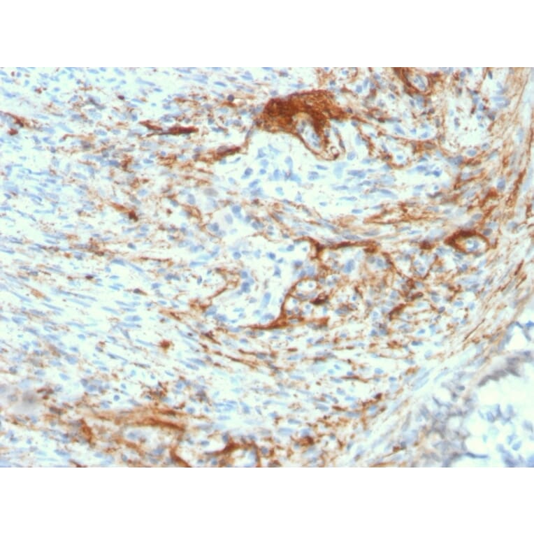 Immunohistochemistry - Anti-Elastin Antibody [ELN/3131R] (A248424) - Antibodies.com
