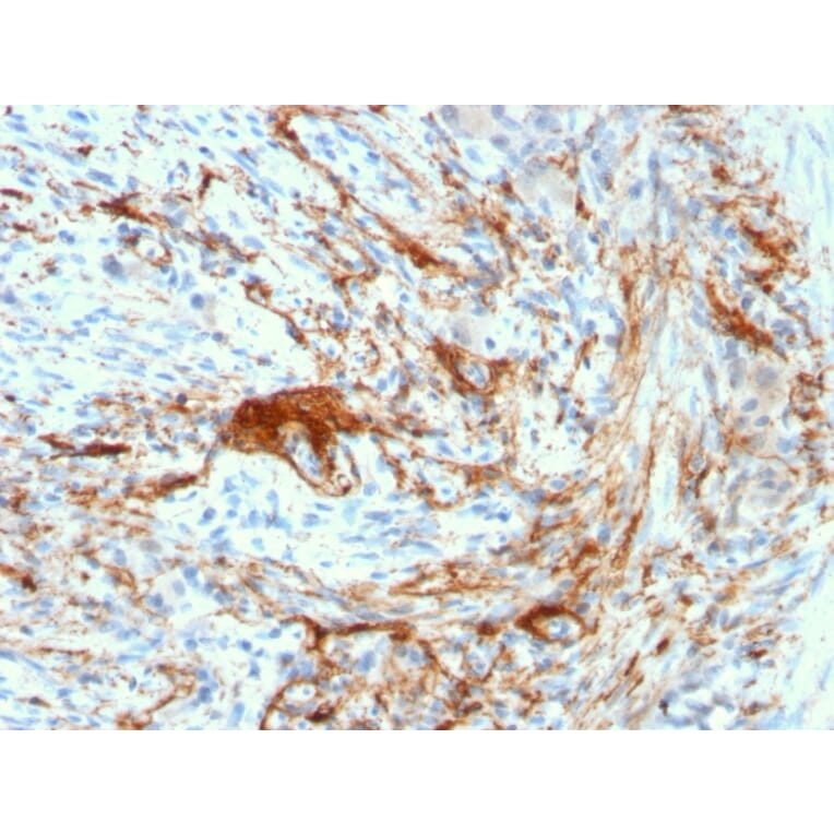 Immunohistochemistry - Anti-Elastin Antibody [ELN/3131R] (A248423) - Antibodies.com