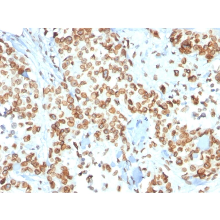 Immunohistochemistry - Anti-Emerin Antibody [EMD/2167] (A248425) - Antibodies.com