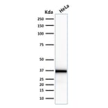 Western Blot - Anti-Emerin Antibody [EMD/2167] (A248425) - Antibodies.com