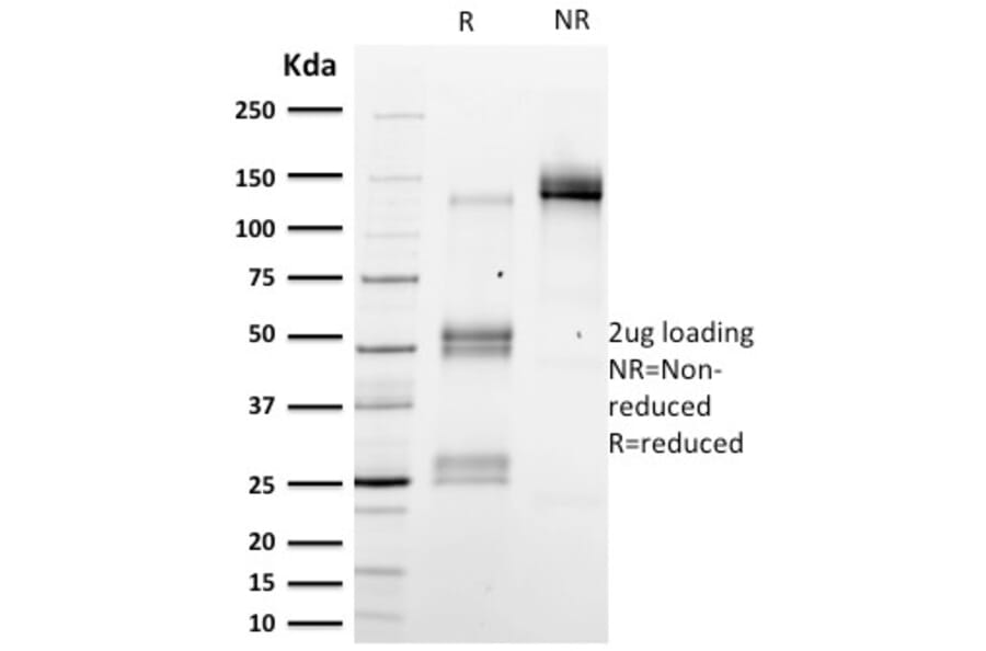 SDS-PAGE - Anti-Emerin Antibody [EMD/2167] (A248425) - Antibodies.com