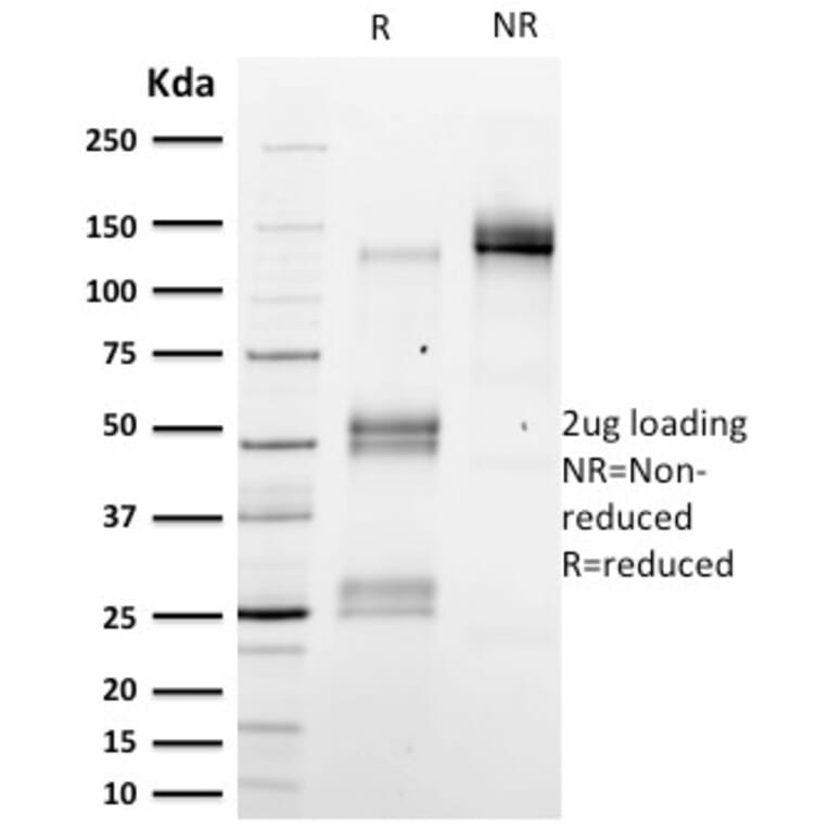 SDS-PAGE - Anti-Emerin Antibody [EMD/2167] (A248425) - Antibodies.com