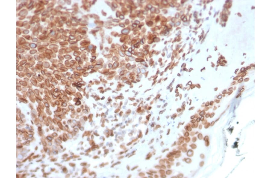 Immunohistochemistry - Anti-Emerin Antibody [EMD/2168] (A248426) - Antibodies.com