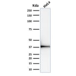 Western Blot - Anti-Emerin Antibody [EMD/2168] (A248426) - Antibodies.com