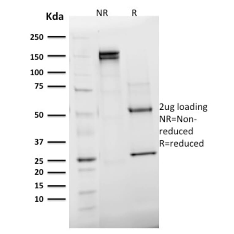 SDS-PAGE - Anti-Emerin Antibody [EMD/2168] (A248426) - Antibodies.com