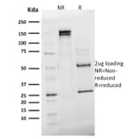 SDS-PAGE - Anti-Emerin Antibody [EMD/2168] (A248426) - Antibodies.com