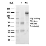 SDS-PAGE - Anti-TIGIT Antibody [TIGIT/3017] (A248428) - Antibodies.com