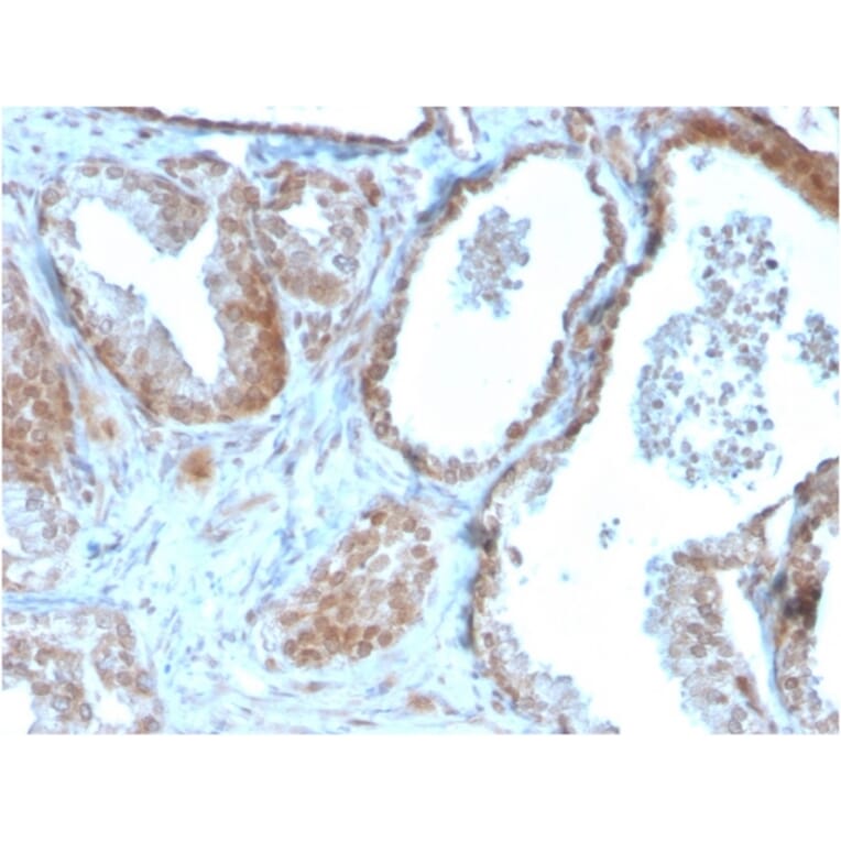 Immunohistochemistry - Anti-TIGIT Antibody [TIGIT/3106] (A248429) - Antibodies.com