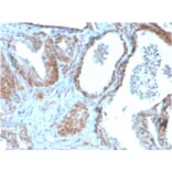 Immunohistochemistry - Anti-TIGIT Antibody [TIGIT/3106] (A248429) - Antibodies.com