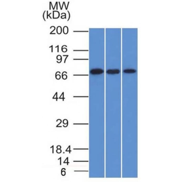 Western Blot - Anti-CD105 Antibody [ENG/1326] (A248430) - Antibodies.com