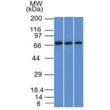 Western Blot - Anti-CD105 Antibody [ENG/1326] (A248430) - Antibodies.com