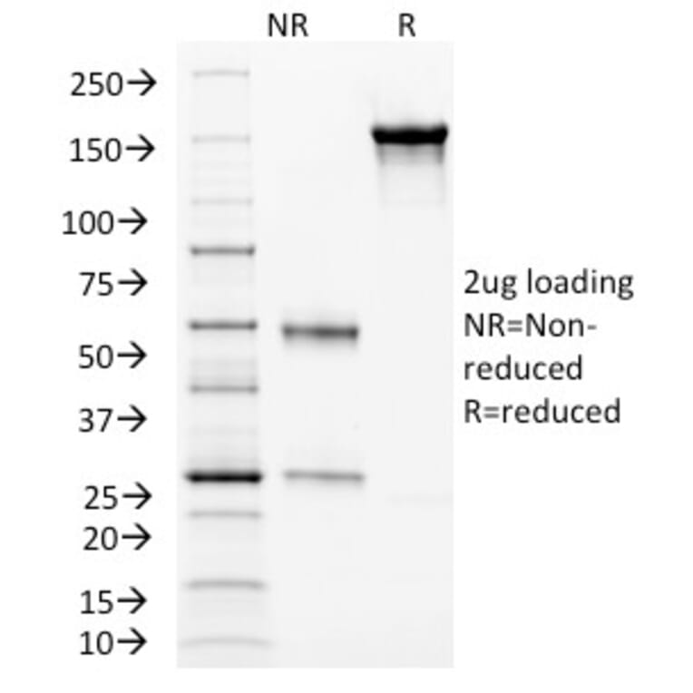 SDS-PAGE - Anti-CD105 Antibody [ENG/1326] (A248429) - Antibodies.com
