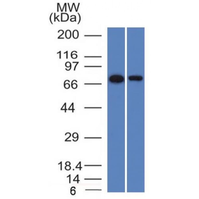Western Blot - Anti-CD105 Antibody [ENG/1327] (A248431) - Antibodies.com