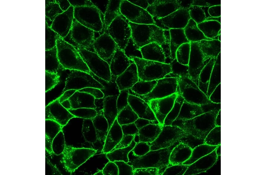 Immunofluorescence - Anti-CD105 Antibody [ENG/1621] (A248433) - Antibodies.com