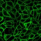 Immunofluorescence - Anti-CD105 Antibody [ENG/1621] (A248433) - Antibodies.com