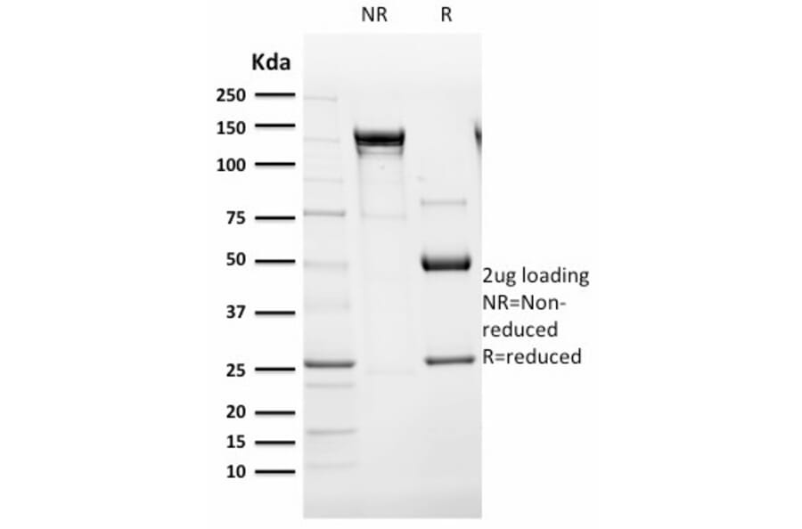SDS-PAGE - Anti-CD105 Antibody [ENG/1621] (A248433) - Antibodies.com