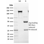 SDS-PAGE - Anti-CD105 Antibody [ENG/1621] (A248433) - Antibodies.com