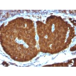 Immunohistochemistry - Anti-Neuron Specific Enolase Antibody [ENO2/1375] (A248434) - Antibodies.com