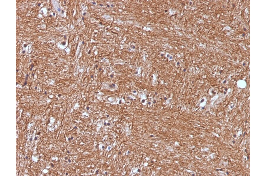 Immunohistochemistry - Anti-Neuron Specific Enolase Antibody [ENO2/1375] (A248433) - Antibodies.com