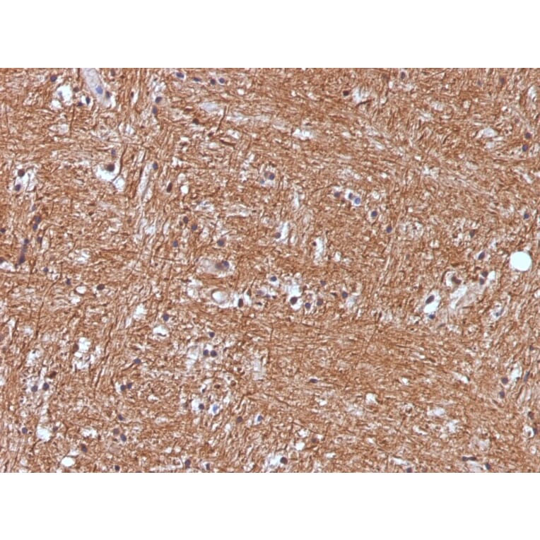 Immunohistochemistry - Anti-Neuron Specific Enolase Antibody [ENO2/1375] (A248433) - Antibodies.com