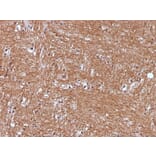 Immunohistochemistry - Anti-Neuron Specific Enolase Antibody [ENO2/1375] (A248433) - Antibodies.com