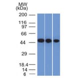 Western Blot - Anti-Neuron Specific Enolase Antibody [ENO2/1375] (A248434) - Antibodies.com
