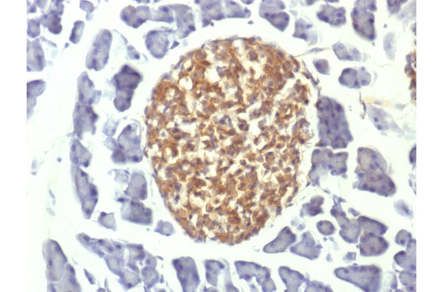 Immunohistochemistry - Anti-Neuron Specific Enolase Antibody [ENO2/1375] (A248434) - Antibodies.com