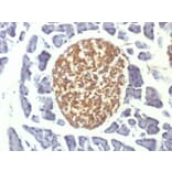 Immunohistochemistry - Anti-Neuron Specific Enolase Antibody [ENO2/1375] (A248434) - Antibodies.com