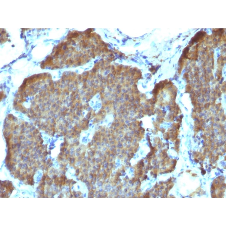 Immunohistochemistry - Anti-Neuron Specific Enolase Antibody [SPM347] (A248434) - Antibodies.com