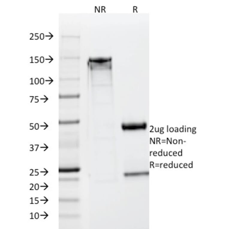 SDS-PAGE - Anti-Neuron Specific Enolase Antibody [SPM347] (A248435) - Antibodies.com