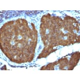 Immunohistochemistry - Anti-Neuron Specific Enolase Antibody [ENO2/1462] (A248436) - Antibodies.com