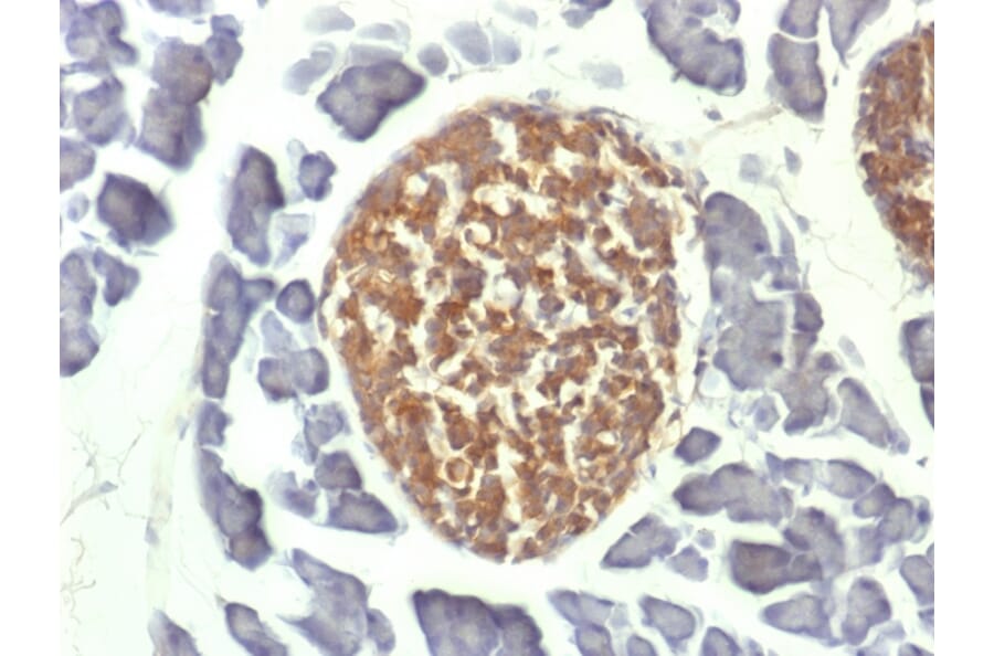 Immunohistochemistry - Anti-Neuron Specific Enolase Antibody [ENO2/1462] (A248436) - Antibodies.com