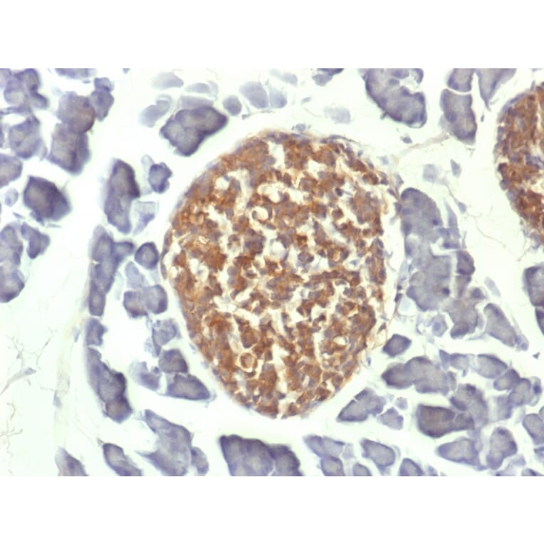 Immunohistochemistry - Anti-Neuron Specific Enolase Antibody [ENO2/1462] (A248436) - Antibodies.com