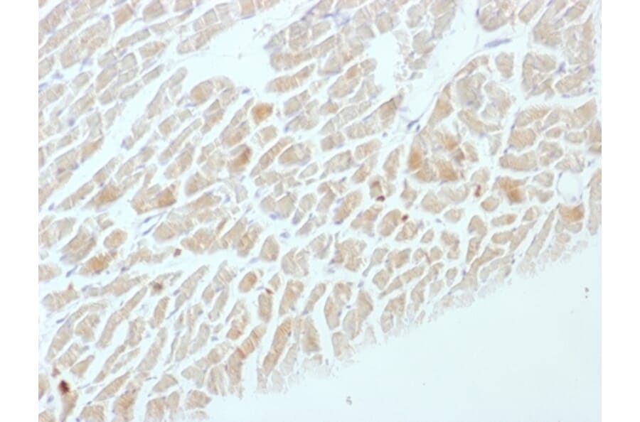 Immunohistochemistry - Anti-Neuron Specific Enolase Antibody [ENO2/1462] (A248436) - Antibodies.com