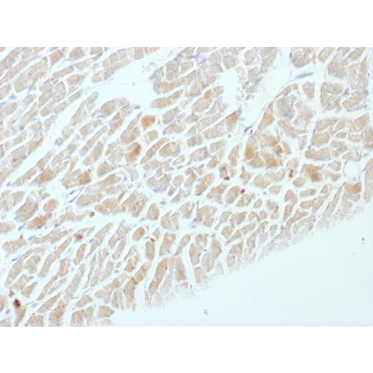 Immunohistochemistry - Anti-Neuron Specific Enolase Antibody [ENO2/1462] (A248436) - Antibodies.com