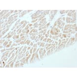 Immunohistochemistry - Anti-Neuron Specific Enolase Antibody [ENO2/1462] (A248436) - Antibodies.com