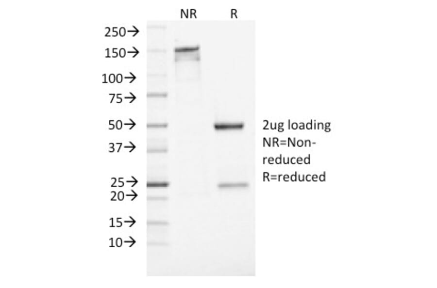 SDS-PAGE - Anti-Neuron Specific Enolase Antibody [ENO2/1462] (A248436) - Antibodies.com