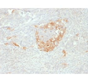 Immunohistochemistry - Anti-Neuron Specific Enolase Antibody [NSE-P2] (A248436) - Antibodies.com