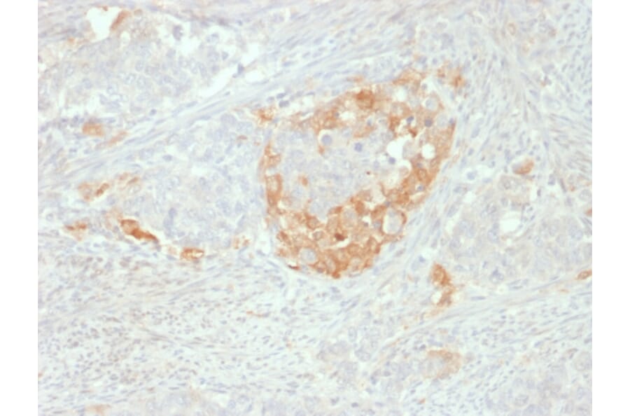 Immunohistochemistry - Anti-Neuron Specific Enolase Antibody [NSE-P2] (A248436) - Antibodies.com