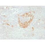 Immunohistochemistry - Anti-Neuron Specific Enolase Antibody [NSE-P2] (A248436) - Antibodies.com