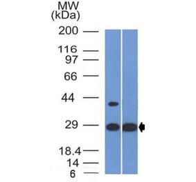 Western Blot - Anti-EPO Antibody [EPO/1368] (A248440) - Antibodies.com