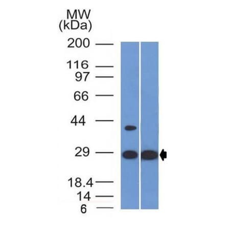 Western Blot - Anti-EPO Antibody [EPO/1368] (A248440) - Antibodies.com