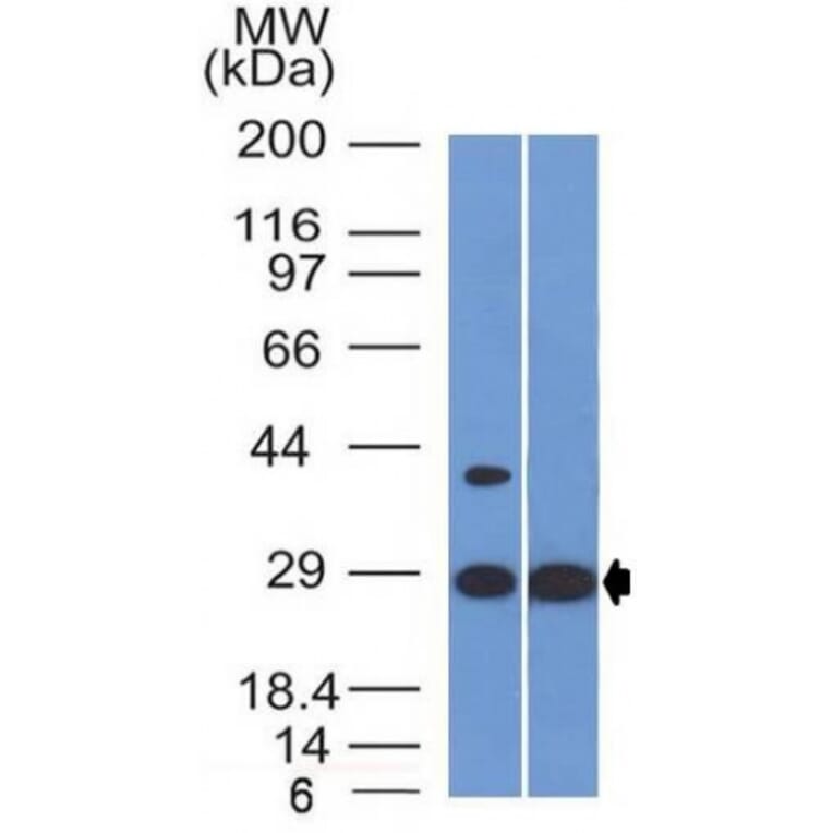 Western Blot - Anti-EPO Antibody [EPO/1368] (A248440) - Antibodies.com