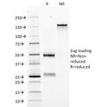 SDS-PAGE - Anti-EPO Antibody [EPO/1368] (A248440) - Antibodies.com